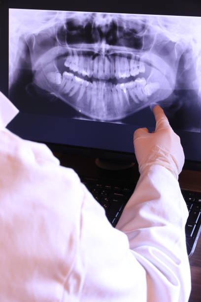 Best Emergency Treatment for Dental Infections or Abscesses in Cadott, WI